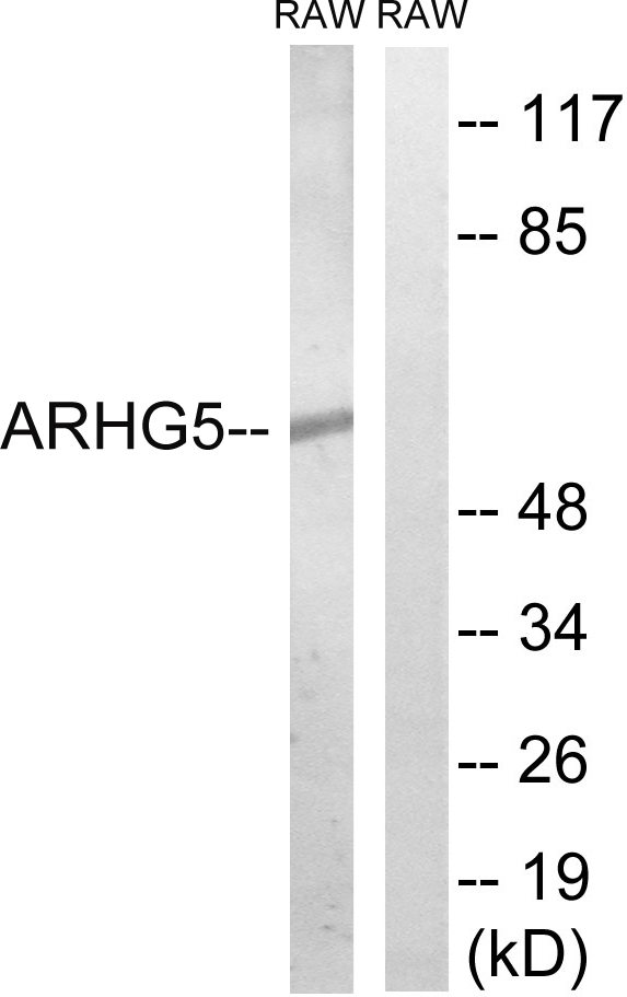 ARHGEF5 Antibody - Western blot analysis of lysates from RAW264.7 cells, using ARHGEF5 Antibody. The lane on the right is blocked with the synthesized peptide.