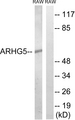 ARHGEF5 Antibody - Western blot analysis of lysates from RAW264.7 cells, using ARHGEF5 Antibody. The lane on the right is blocked with the synthesized peptide.