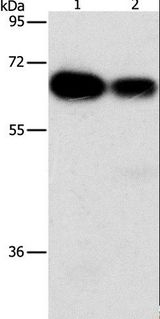 ARHGEF5 Antibody - Western blot analysis of HeLa and K562 cell, using ARHGEF5 Polyclonal Antibody at dilution of 1:1150.