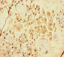 ARHGEF5 Antibody - Immunohistochemistry of paraffin-embedded human placenta tissue at dilution of 1:100
