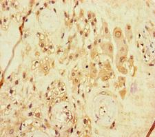 ARHGEF5 Antibody - Immunohistochemistry of paraffin-embedded human placenta tissue at dilution of 1:100