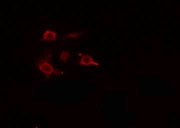 ARHGEF5 Antibody - Staining RAW264.7 cells by IF/ICC. The samples were fixed with PFA and permeabilized in 0.1% Triton X-100, then blocked in 10% serum for 45 min at 25°C. The primary antibody was diluted at 1:200 and incubated with the sample for 1 hour at 37°C. An Alexa Fluor 594 conjugated goat anti-rabbit IgG (H+L) antibody, diluted at 1/600, was used as secondary antibody.