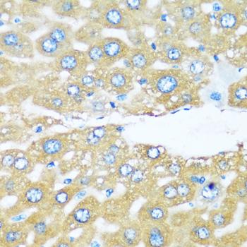 ARHGEF5 Antibody - Immunohistochemistry of paraffin-embedded Mouse liver using ARHGEF5 Polyclonal Antibody at dilution of 1:100 (40x lens).