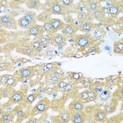 ARHGEF5 Antibody - Immunohistochemistry of paraffin-embedded Mouse liver using ARHGEF5 Polyclonal Antibody at dilution of 1:100 (40x lens).