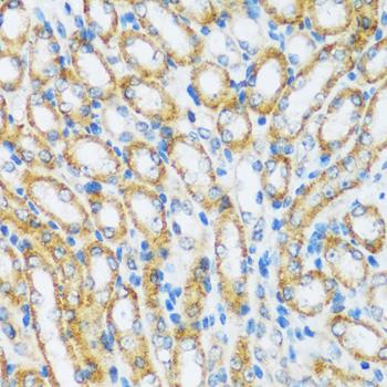 ARHGEF5 Antibody - Immunohistochemistry of paraffin-embedded Mouse kidney using ARHGEF5 Polyclonal Antibody at dilution of 1:100 (40x lens).