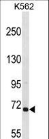 ARHGEF6 Antibody - ARHGEF6 Antibody western blot of K562 cell line lysates (35 ug/lane). The ARHGEF6 antibody detected the ARHGEF6 protein (arrow).