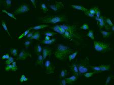 ARHGEF6 Antibody - Immunofluorescence staining of ARHGEF6 in U251MG cells. Cells were fixed with 4% PFA, permeabilzed with 0.1% Triton X-100 in PBS, blocked with 10% serum, and incubated with rabbit anti-Human ARHGEF6 polyclonal antibody (dilution ratio 1:100) at 4°C overnight. Then cells were stained with the Alexa Fluor 488-conjugated Goat Anti-rabbit IgG secondary antibody (green) and counterstained with DAPI (blue). Positive staining was localized to Cytoplasm.