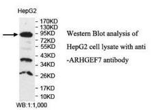 ARHGEF7 Antibody - Western blot of ARHGEF7 antibody