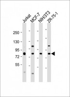 ARHGEF7 Antibody - All lanes: Anti-ARHGEF7 Antibody (C-Term) at 1:2000 dilution Lane 1: Jurkat whole cell lysate Lane 2: MCF-7 whole cell lysate Lane 3: NIH/3T3 whole cell lysate Lane 4: ZR-75-1 whole cell lysate Lysates/proteins at 20 µg per lane. Secondary Goat Anti-Rabbit IgG, (H+L), Peroxidase conjugated at 1/10000 dilution. Predicted band size: 90 kDa Blocking/Dilution buffer: 5% NFDM/TBST.