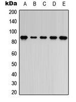 ARHGEF7 Antibody - Western blot analysis of ARHGEF7 expression in Jurkat (A); K562 (B); mouse brain (C); mouse heart (D); rat heart (E) whole cell lysates.