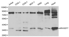 ARHGEF7 Antibody - Western blot of ARHGEF7 pAb in extracts from Jurkat, COS1, COS7, MCF7, K562 cells and mouse lung, heart tissues.