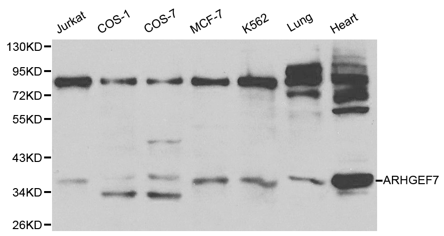 ARHGEF7 Antibody - Western blot of ARHGEF7 pAb in extracts from Jurkat, COS1, COS7, MCF7, K562 cells and mouse lung, heart tissues.