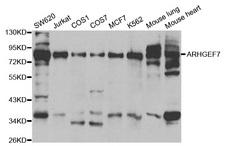 ARHGEF7 Antibody - Western blot analysis of extracts of various cell lines, using ARHGEF7 antibody at 1:500 dilution. The secondary antibody used was an HRP Goat Anti-Rabbit IgG (H+L) at 1:10000 dilution. Lysates were loaded 25ug per lane and 3% nonfat dry milk in TBST was used for blocking.