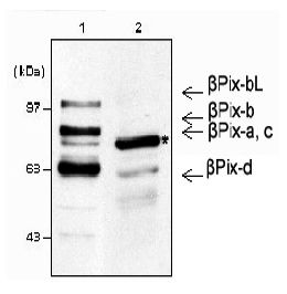 ARHGEF7 Antibody - Western blot analysis using anti-beta-Pix (mouse), pAb . 1: Mouse brain lysates (30 ug). 2: NIH3T3 whole cell lysates (30 ug). . * beta-Pix is a major isoform in NIH3T3 lysates, while other beta-Pix isoforms are also detected in mouse brain lysates.  This image was taken for the unconjugated form of this product. Other forms have not been tested.
