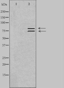 ARHGEF7 Antibody - Western blot analysis of extracts of rat muscle cells using ARHGEF7 antibody. The lane on the left is treated with the antigen-specific peptide.