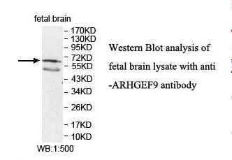 ARHGEF9 / Collybistin Antibody