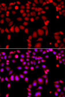 ARHGEF9 / Collybistin Antibody - Immunofluorescence analysis of A549 cells.