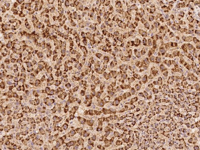 ARHGEF9 / Collybistin Antibody - Immunochemical staining of human ARHGEF9 in human liver with rabbit polyclonal antibody at 1:100 dilution, formalin-fixed paraffin embedded sections.