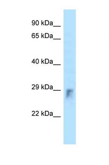 ARHU / RHOU Antibody - RHOU antibody Western blot of Small Intestine lysate. Antibody concentration 1 ug/ml.  This image was taken for the unconjugated form of this product. Other forms have not been tested.