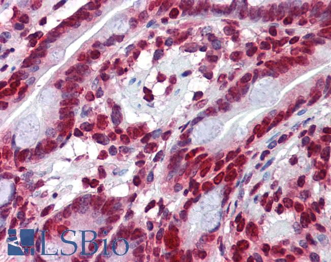 ARHU / RHOU Antibody - Anti-RHOU antibody IHC of human small intestine. Immunohistochemistry of formalin-fixed, paraffin-embedded tissue after heat-induced antigen retrieval. Antibody concentration 5 ug/ml.  This image was taken for the unconjugated form of this product. Other forms have not been tested.