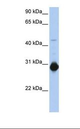 ARHU / RHOU Antibody - Fetal muscle lysate. Antibody concentration: 1.0 ug/ml. Gel concentration: 12%.  This image was taken for the unconjugated form of this product. Other forms have not been tested.