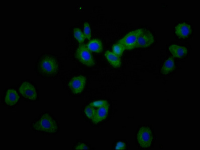 ARHU / RHOU Antibody - Immunofluorescence staining of HepG2 cells at a dilution of 1:166, counter-stained with DAPI. The cells were fixed in 4% formaldehyde, permeabilized using 0.2% Triton X-100 and blocked in 10% normal Goat Serum. The cells were then incubated with the antibody overnight at 4 °C.The secondary antibody was Alexa Fluor 488-congugated AffiniPure Goat Anti-Rabbit IgG (H+L) .