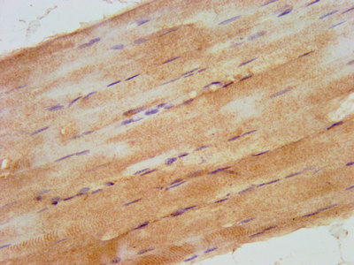 ARHU / RHOU Antibody - Immunohistochemistry image at a dilution of 1:500 and staining in paraffin-embedded human skeletal muscle tissue performed on a Leica BondTM system. After dewaxing and hydration, antigen retrieval was mediated by high pressure in a citrate buffer (pH 6.0) . Section was blocked with 10% normal goat serum 30min at RT. Then primary antibody (1% BSA) was incubated at 4 °C overnight. The primary is detected by a biotinylated secondary antibody and visualized using an HRP conjugated SP system.