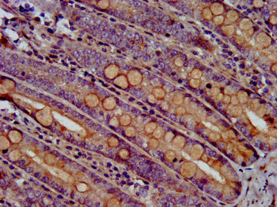 ARHU / RHOU Antibody - Immunohistochemistry image at a dilution of 1:500 and staining in paraffin-embedded human small intestine tissue performed on a Leica BondTM system. After dewaxing and hydration, antigen retrieval was mediated by high pressure in a citrate buffer (pH 6.0) . Section was blocked with 10% normal goat serum 30min at RT. Then primary antibody (1% BSA) was incubated at 4 °C overnight. The primary is detected by a biotinylated secondary antibody and visualized using an HRP conjugated SP system.