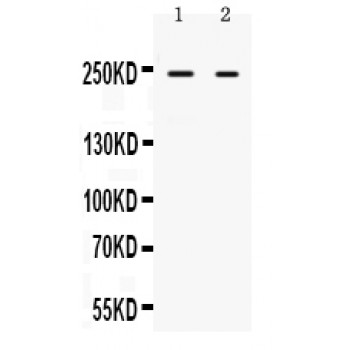 ARID1A / BAF250 Antibody - ARID1A antibody Western blot. All lanes: Anti ARID1A at 0.5 ug/ml. Lane 1: SW620 Whole Cell Lysate at 40 ug. Lane 2: HEPG2 Whole Cell Lysate at 40 ug. Predicted band size: 242 kD. Observed band size: 242 kD.