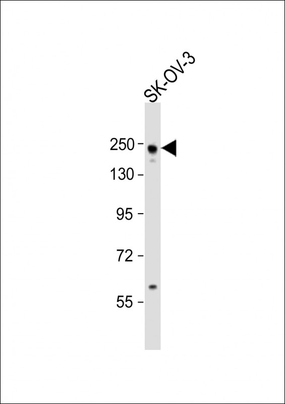 ARID1A / BAF250 Antibody - Anti-ARID1A Antibody (C-Term) at 1:2000 dilution + SK-OV-3 whole cell lysate Lysates/proteins at 20 ug per lane. Secondary Goat Anti-Rabbit IgG, (H+L), Peroxidase conjugated at 1:10000 dilution. Predicted band size: 242 kDa. Blocking/Dilution buffer: 5% NFDM/TBST.