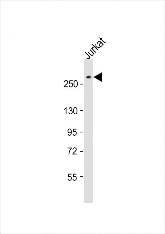 ARID1A / BAF250 Antibody - Anti-ARID1A Antibody (C-Term) at 1:2000 dilution + Jurkat whole cell lysate Lysates/proteins at 20 ug per lane. Secondary Goat Anti-Rabbit IgG, (H+L), Peroxidase conjugated at 1:10000 dilution. Predicted band size: 242 kDa. Blocking/Dilution buffer: 5% NFDM/TBST.