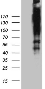 ARID1A / BAF250 Antibody - HEK293T cells were transfected with the pCMV6-ENTRY control. (Left lane) or pCMV6-ENTRY ARID1A. (Right lane) cDNA for 48 hrs and lysed