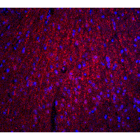 ARID1A / BAF250 Antibody - Immunofluorescence of ARID1A in mouse brain tissue with ARID1A antibody at 20 µg/ml.