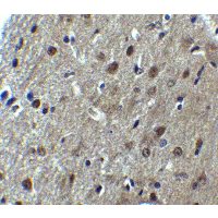ARID1A / BAF250 Antibody - Immunohistochemistry of ARID1A in mouse brain tissue with ARID1A antibody at 5 µg/mL.