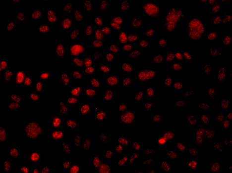 ARID1A / BAF250 Antibody - Immunofluorescence analysis of A549 cells.