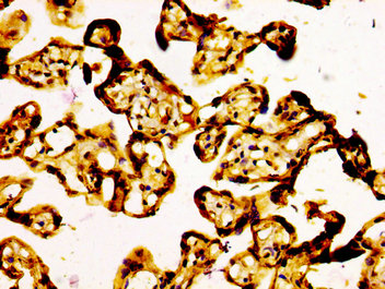 ARID1A / BAF250 Antibody - Immunohistochemistry image at a dilution of 1:500 and staining in paraffin-embedded human placenta tissue performed on a Leica BondTM system. After dewaxing and hydration, antigen retrieval was mediated by high pressure in a citrate buffer (pH 6.0) . Section was blocked with 10% normal goat serum 30min at RT. Then primary antibody (1% BSA) was incubated at 4 °C overnight. The primary is detected by a biotinylated secondary antibody and visualized using an HRP conjugated SP system.