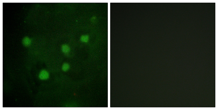 ARID1B / BAF250B Antibody - Immunofluorescence analysis of HUVEC cells, using BAF250B Antibody. The picture on the right is blocked with the synthesized peptide.