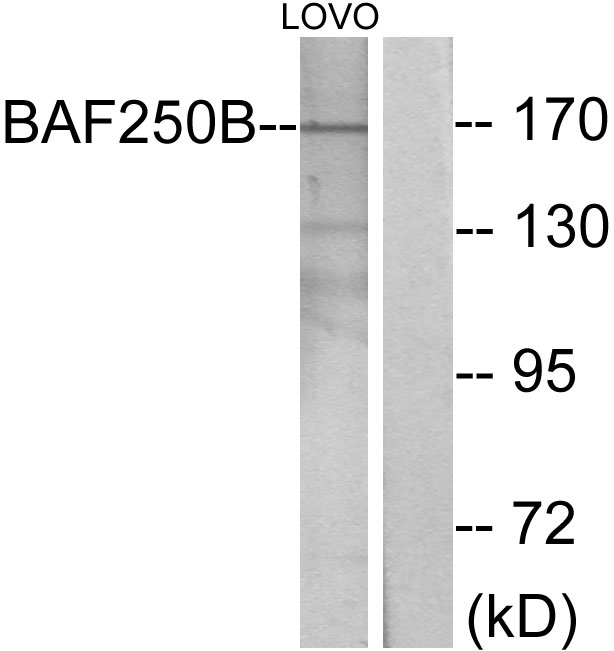 ARID1B / BAF250B Antibody - Western blot analysis of lysates from LOVO cells, using BAF250B Antibody. The lane on the right is blocked with the synthesized peptide.