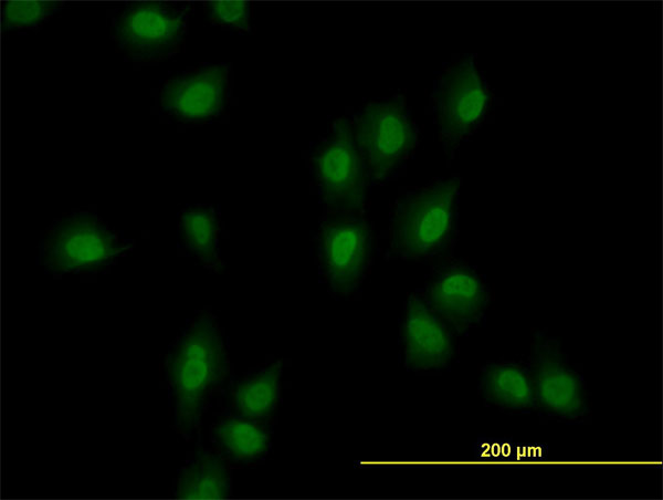 ARID1B / BAF250B Antibody - Immunofluorescence of monoclonal antibody to ARID1B on HeLa cell. [antibody concentration 10 ug/ml]