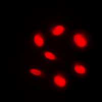 ARID1B / BAF250B Antibody - Immunofluorescent analysis of BAF250B staining in HeLa cells. Formalin-fixed cells were permeabilized with 0.1% Triton X-100 in TBS for 5-10 minutes and blocked with 3% BSA-PBS for 30 minutes at room temperature. Cells were probed with the primary antibody in 3% BSA-PBS and incubated overnight at 4 C in a humidified chamber. Cells were washed with PBST and incubated with a DyLight 594-conjugated secondary antibody (red) in PBS at room temperature in the dark. DAPI was used to stain the cell nuclei (blue).