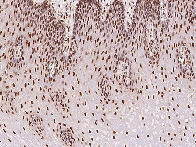 ARID1B / BAF250B Antibody - Immunochemical staining of human ARID1B in human esophagus with rabbit polyclonal antibody at 1:100 dilution, formalin-fixed paraffin embedded sections.