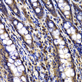 ARID3A / DRIL1 Antibody - Immunohistochemistry of paraffin-embedded rat ileum tissue.