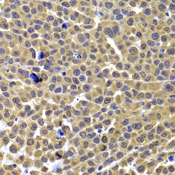 ARID3A / DRIL1 Antibody - Immunohistochemistry of paraffin-embedded mouse cancer tissue.