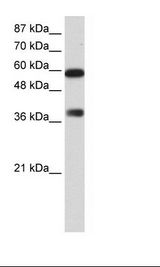 ARID3B Antibody - HepG2 Cell Lysate.  This image was taken for the unconjugated form of this product. Other forms have not been tested.