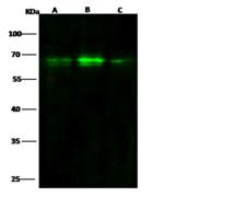 ARID3B Antibody - Anti-ARID3B rabbit monoclonal antibody at 1:500 dilution. Lane A: 293T Whole Cell Lysate. Lane B: K562 Whole Cell Lysate. Lane C: HepG2 Whole Cell Lysate. Lysates/proteins at 30 ug per lane. Secondary: Goat Anti-Rabbit IgG H&L (Dylight800) at 1/10000 dilution. Developed using the Odyssey technique. Performed under reducing conditions. Predicted band size: 61 kDa. Observed band size: 68 kDa.