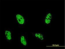 ARID4A Antibody - Immunofluorescence of monoclonal antibody to ARID4A on HeLa cell . [antibody concentration 10 ug/ml]