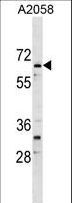 ARID5A Antibody - ARID5A Antibody western blot of A2058 cell line lysates (35 ug/lane). The ARID5A antibody detected the ARID5A protein (arrow).
