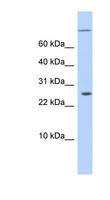 ARID5A Antibody - ARID5A antibody Western blot of COLO205 cell lysate. This image was taken for the unconjugated form of this product. Other forms have not been tested.