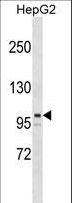 ARID5B Antibody - ARID5B Antibody western blot of HepG2 cell line lysates (35 ug/lane). The ARID5B antibody detected the ARID5B protein (arrow).