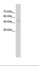 ARIH1 Antibody - Jurkat Cell Lysate.  This image was taken for the unconjugated form of this product. Other forms have not been tested.